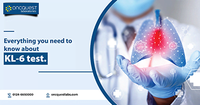 Early Detection of Interstitial Lung Disease